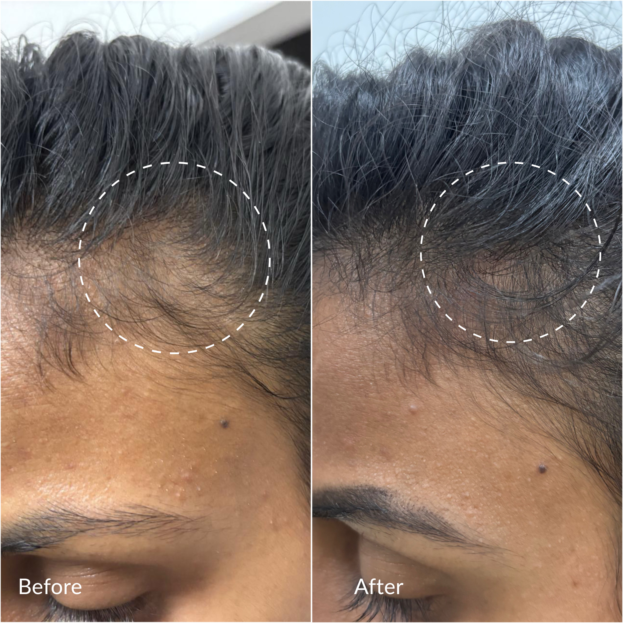 TRIPEPTIDE HAIR DENSITY SERUM
