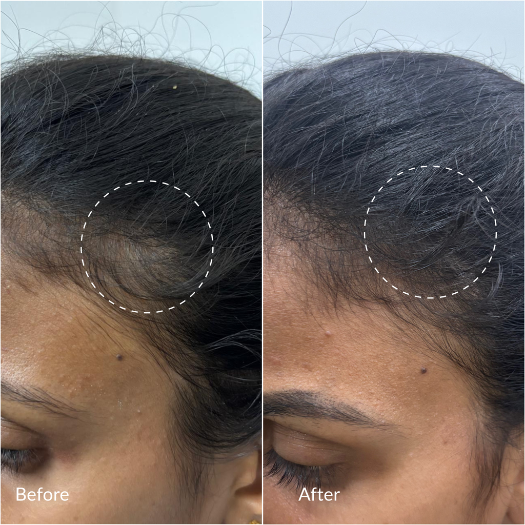 TRIPEPTIDE HAIR DENSITY SERUM